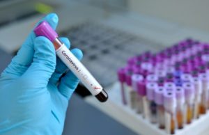 Monitoreo del COVID19 en Honduras: 9 de abril del 2020